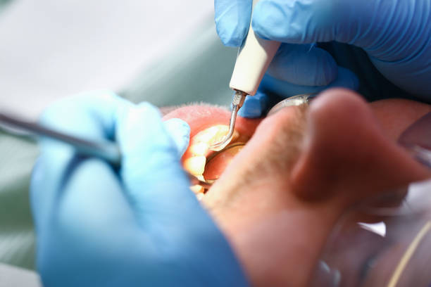 Best Knocked-Out Tooth Emergency  in New Franklin, OH