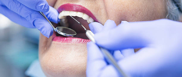 Best Chipped Tooth Repair Near Me  in New Franklin, OH